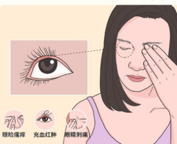 去眼袋手术