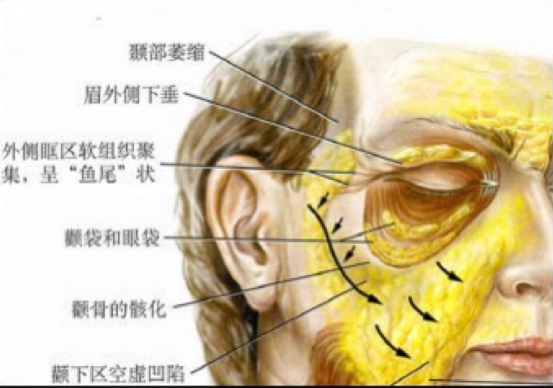 去眼袋手术