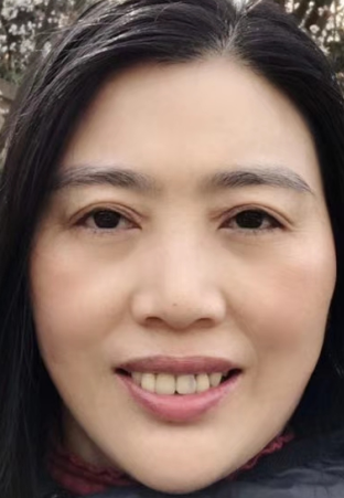 去眼袋手术