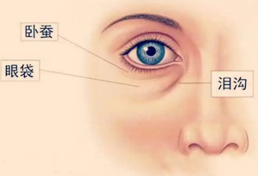 去眼袋手术