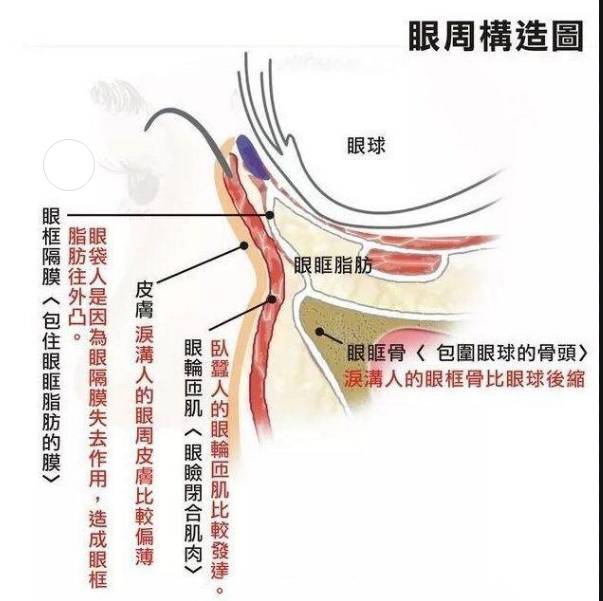 去眼袋手术