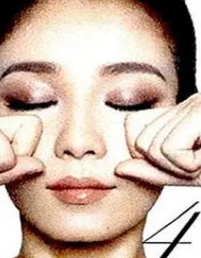 去眼袋手术