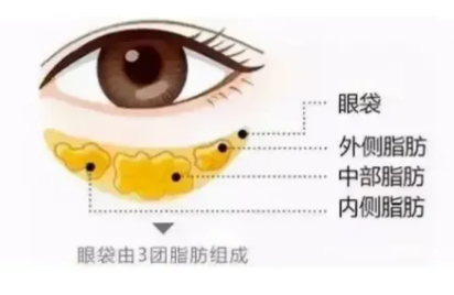 去眼袋手术