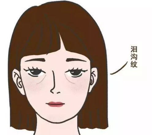 泪沟