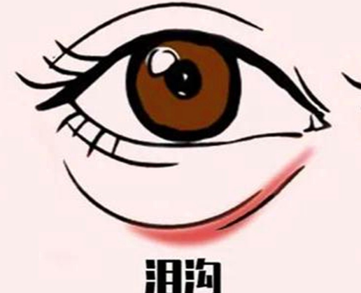 泪沟