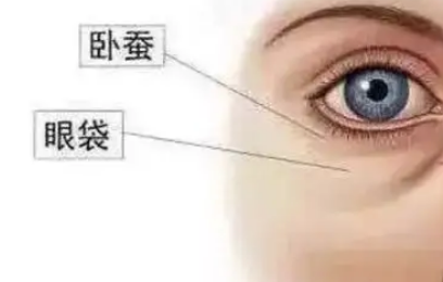 去眼袋手术