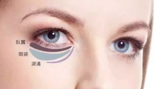 眼袋
