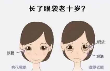 去眼袋手术