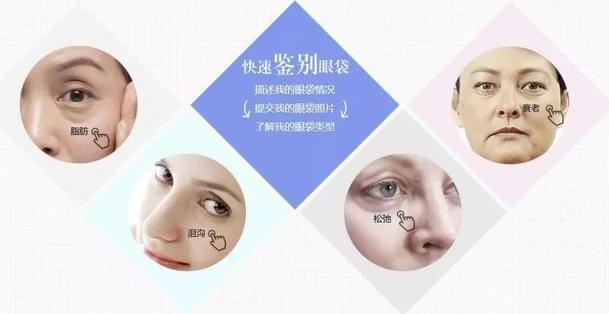 去眼袋手术