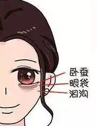 去眼袋手术