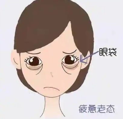 去眼袋手术