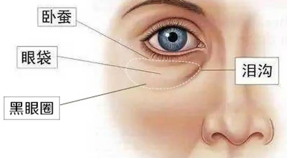 眼袋