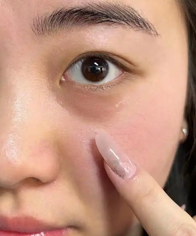 眼袋