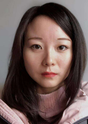 去眼袋手术