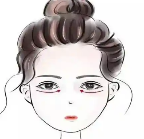 眼袋