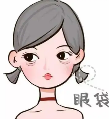 去眼袋手术