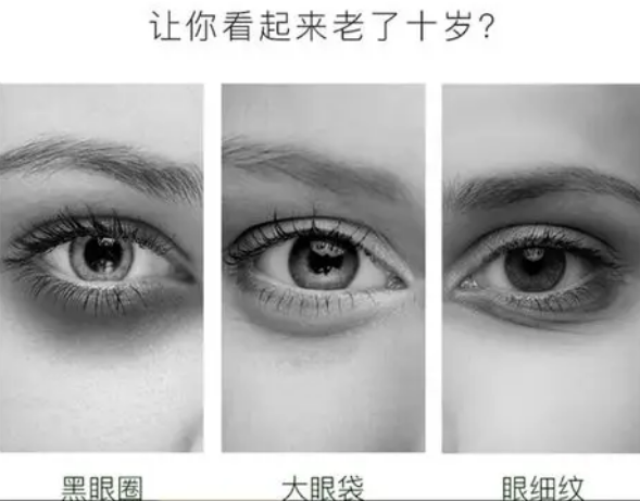 去眼袋手术