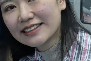 去眼袋手术