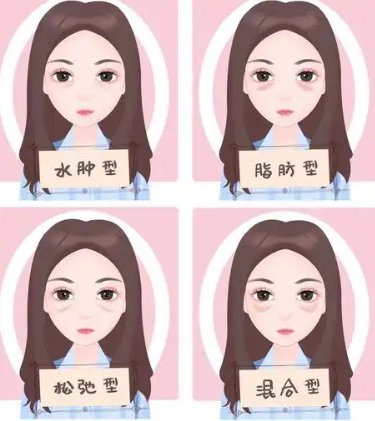 去眼袋手术
