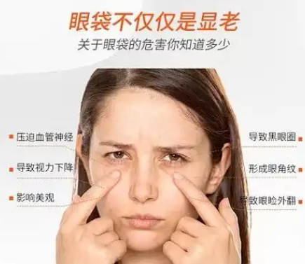 去眼袋手术