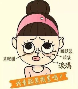 眼袋