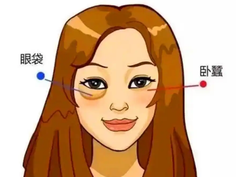 眼袋