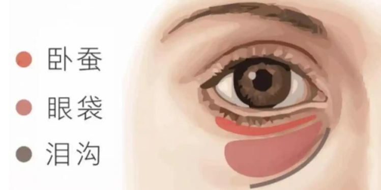去眼袋手术