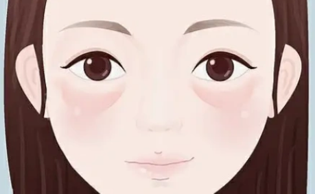 去眼袋手术