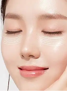 去眼袋手术