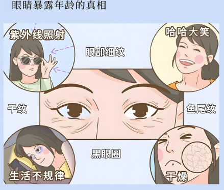 去眼袋手术