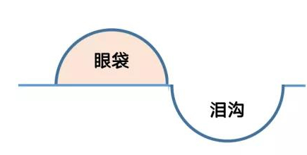 眼袋