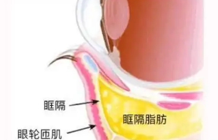 眼袋