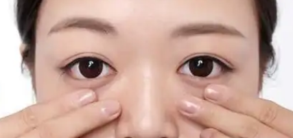 眼袋