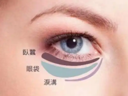 眼袋