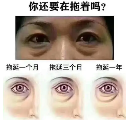 去眼袋手术