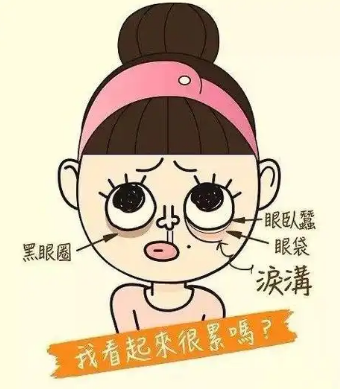 去眼袋手术