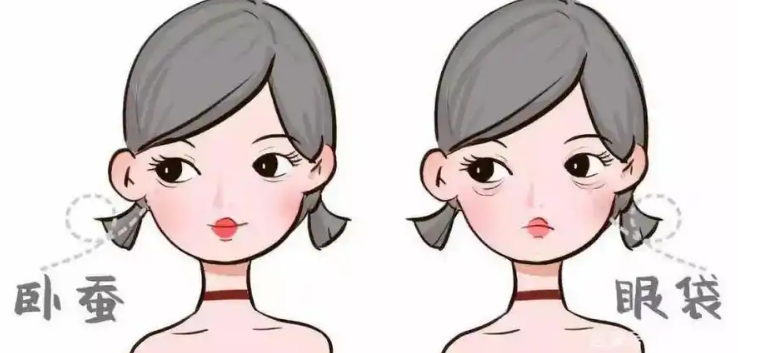 去眼袋手术