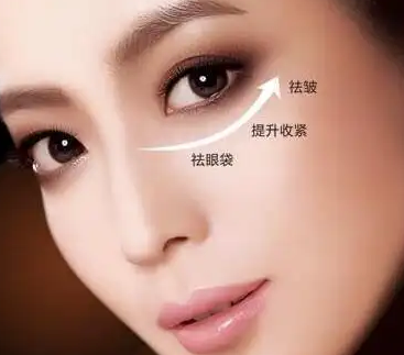 去眼袋手术