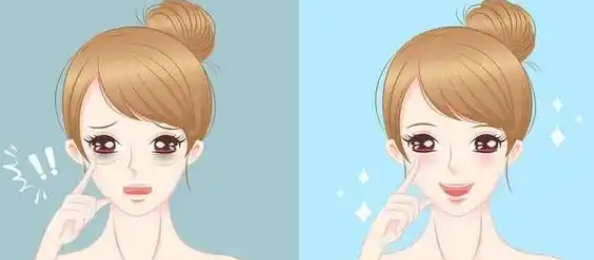 去眼袋手术