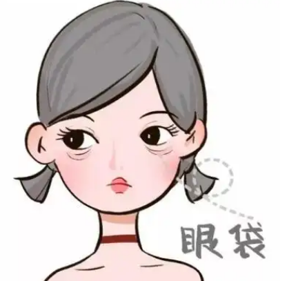 去眼袋手术