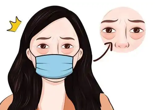 去眼袋手术