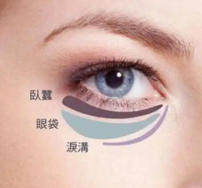 眼袋