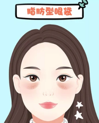 去眼袋手术