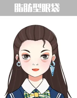 去眼袋手术