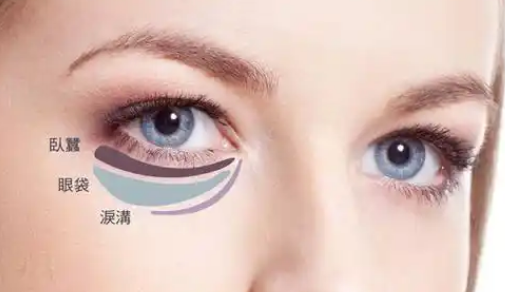 眼袋