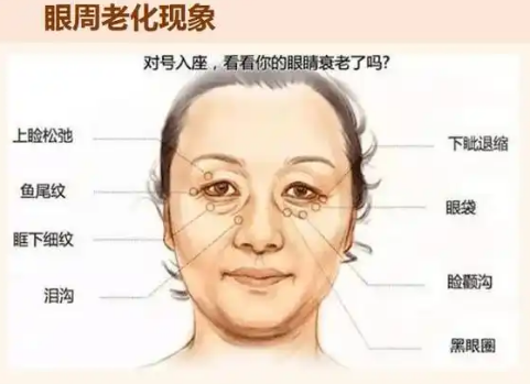 去眼袋手术