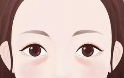 去眼袋手术
