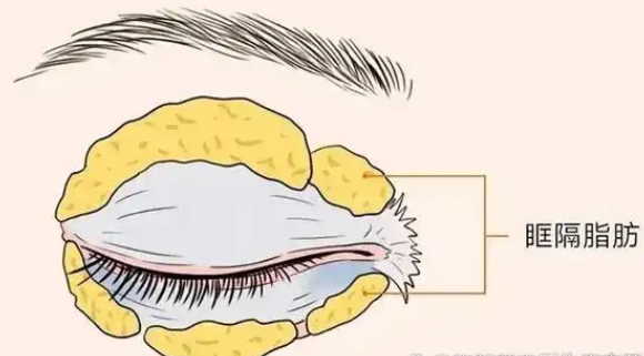 ۴