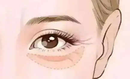 ۴