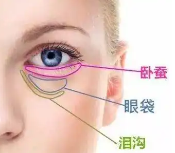 去眼袋手术